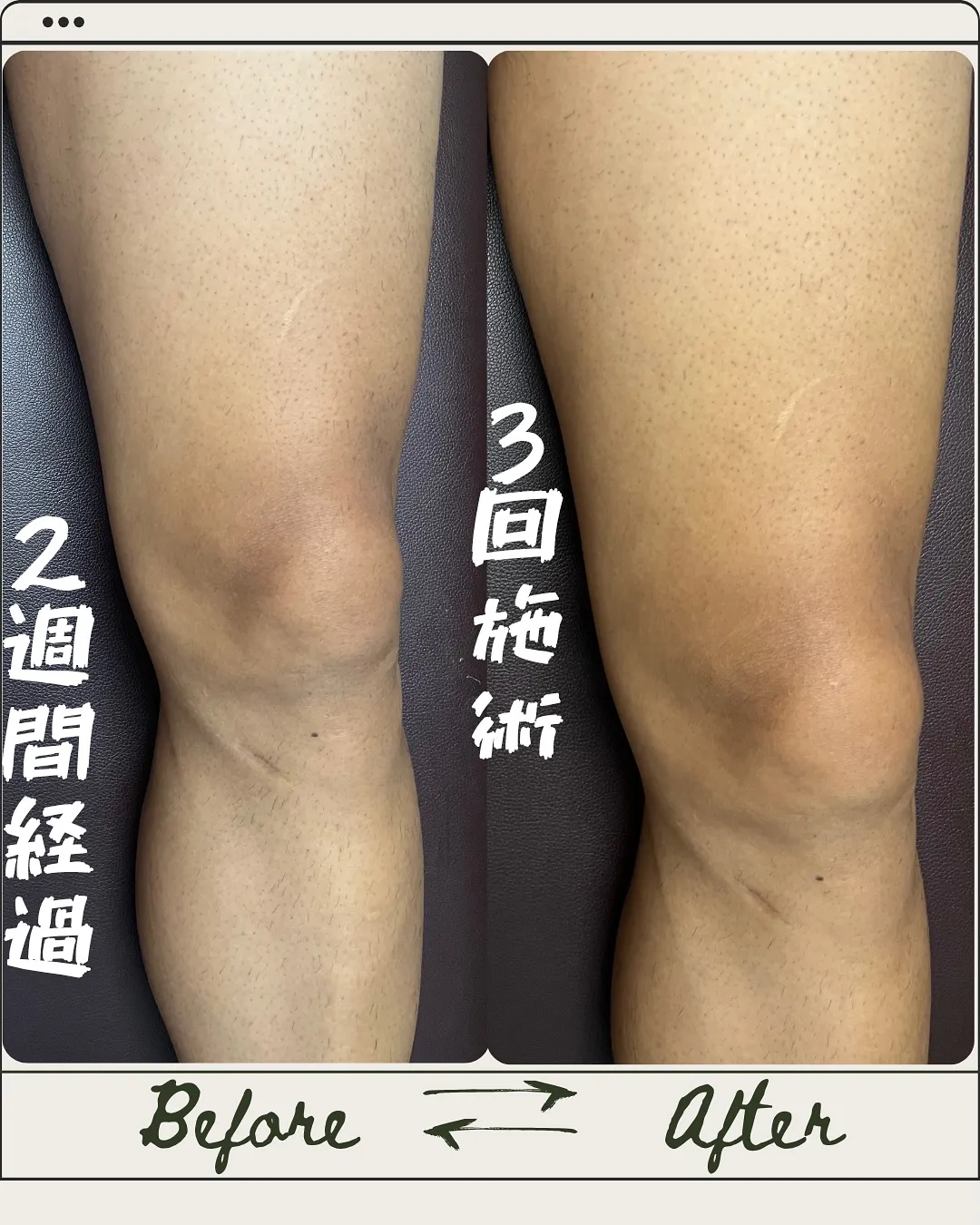 📸 2週間放置でもこの違い…!