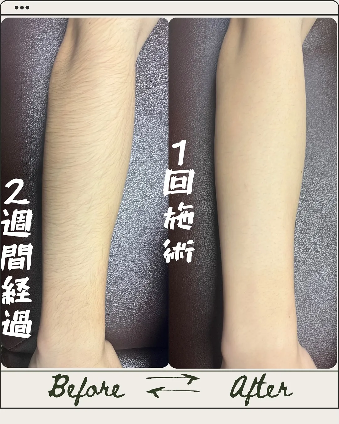 腕キレイなだけで、印象変わる✨