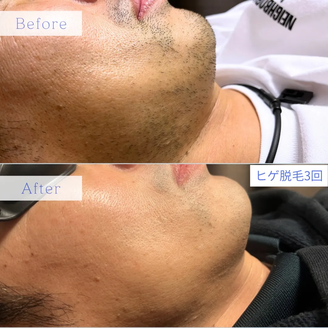 ✨《12月限定キャンペーン》✨