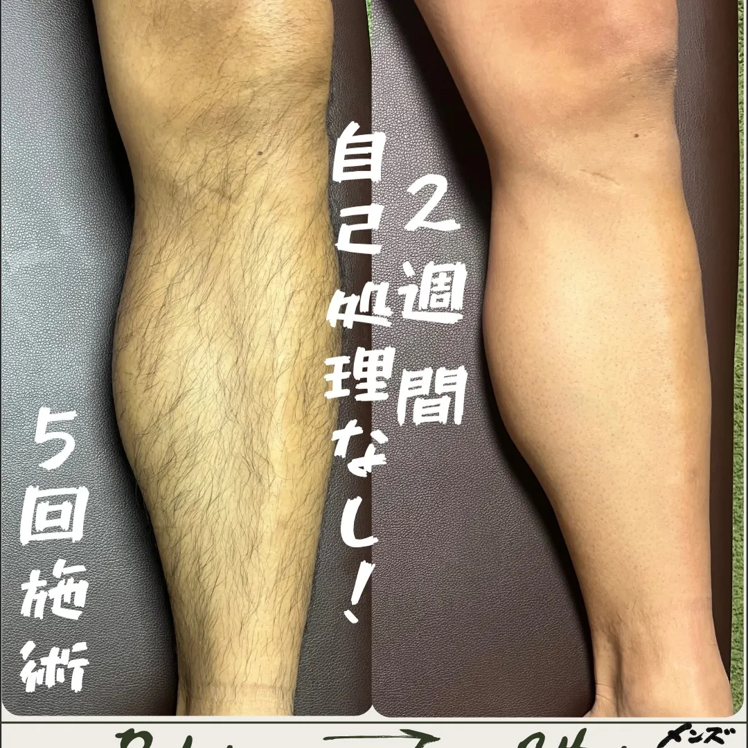 ✨《12月限定キャンペーン》✨