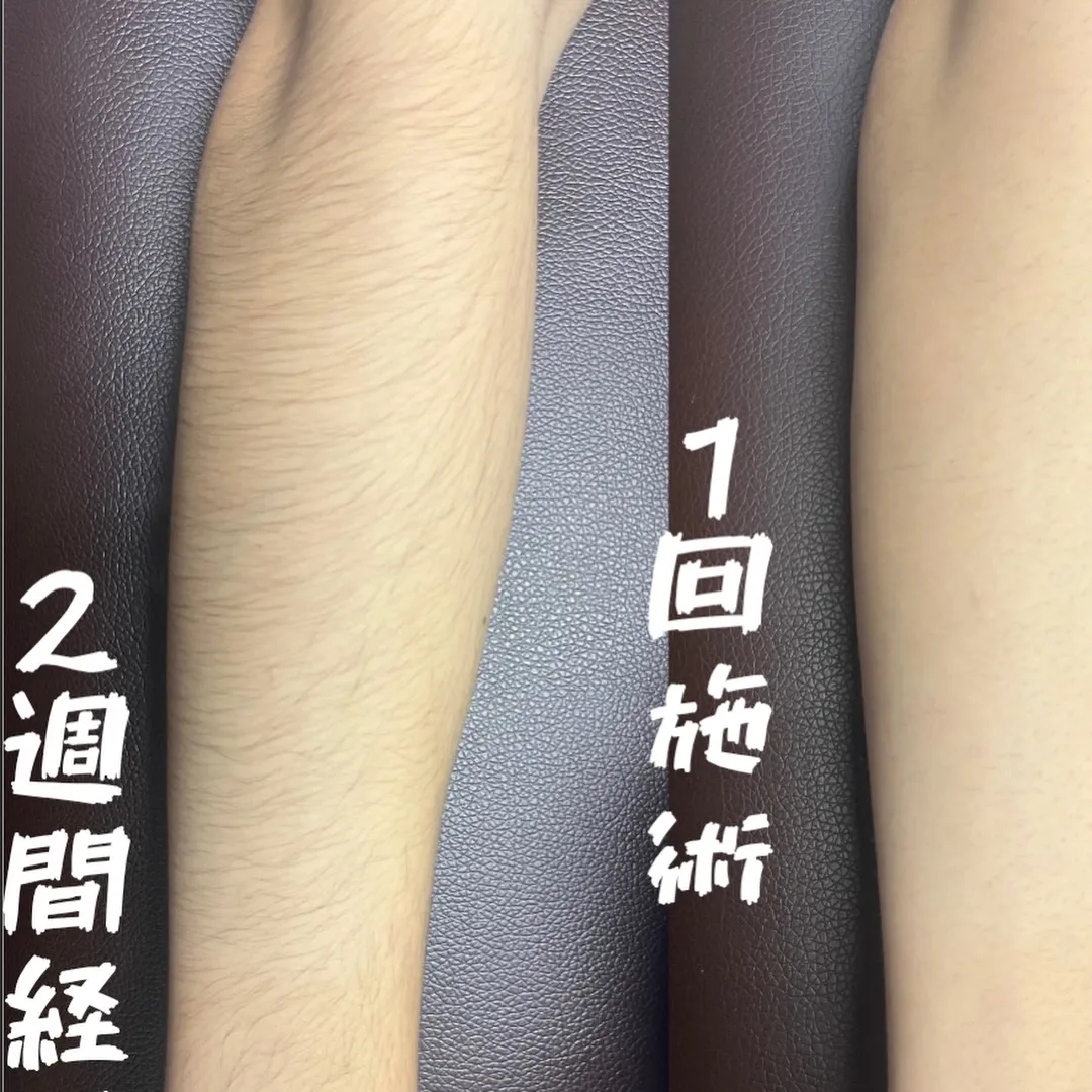 ✨《12月限定キャンペーン》✨